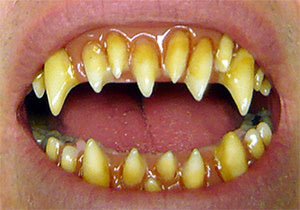 Dents Dental Distorsions - Morlock - Party Shop